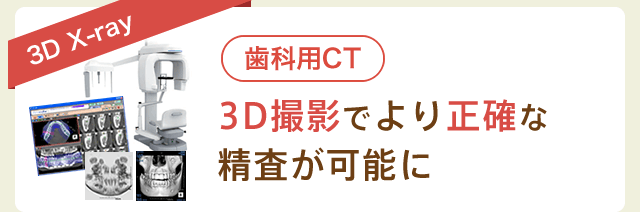 歯科用CT：3D撮影でより正確な精査が可能に